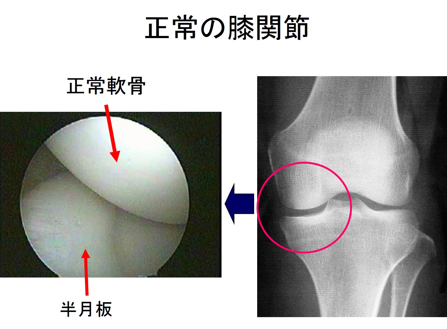 16-膝写真１.png.jpg